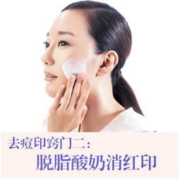 如何去除痘印最有效:告别顽固痘印!科学方法助你重获无瑕肌肤 如何去除痘印最有效:告别顽固痘印!科学方法助你重获无瑕肌肤
