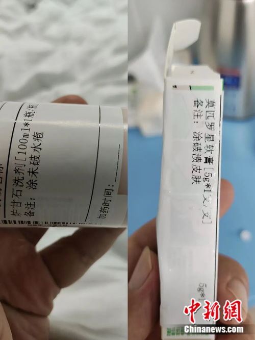 猴痘初期皮疹照片:猴痘初期皮疹特征与识别要点