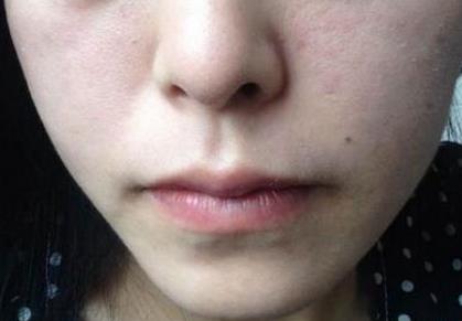 长痘是缺水还是太油:长痘是缺水还是太油?揭秘痘痘背后的真相! 长痘是缺水还是太油:长痘是缺水还是太油?揭秘痘痘背后的真相!