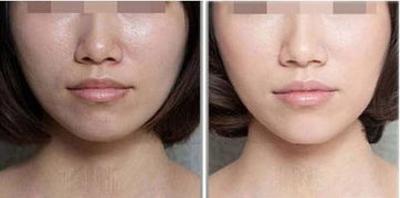 皮肤美容激光哪家医院效果好：2024年皮肤美容激光医院TOP榜单！附详细对比指南，助你找到靠谱机构