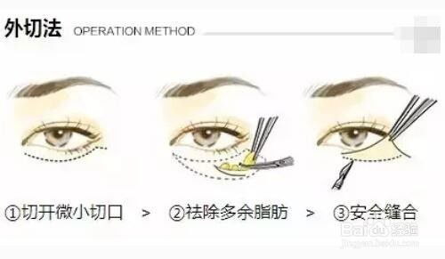 土方去眼袋的小偏方:土方去眼袋的小偏方,这些方法你试过吗? 土方去眼袋的小偏方:土方去眼袋的小偏方,这些方法你试过吗?