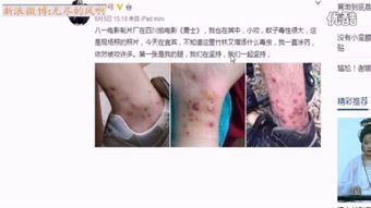 梦见被蛇咬伤脚:解密梦境,被蛇咬伤脚的隐喻与启示