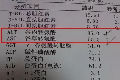 转氨酶高100多严重吗:转氨酶高100多,严重吗?医生这样说,看完别慌! 转氨酶高100多严重吗:转氨酶高100多,严重吗?医生这样说,看完别慌!