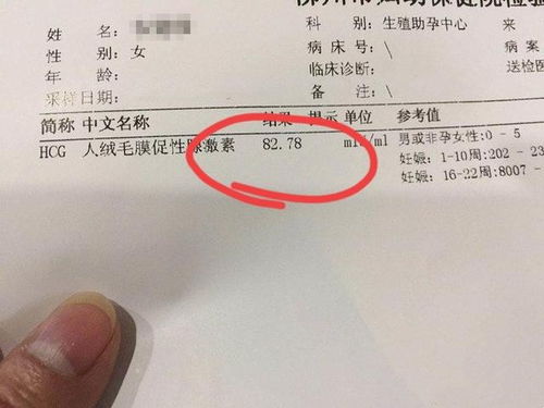 hcg多少就不担心宫外孕：HCG值与宫外孕的关系，了解HCG数值，安心度过孕期