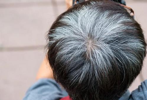 梦见自己头发白了好多是什么征兆：梦见自己头发白了好多是什么征兆？梦境启示与心理解读