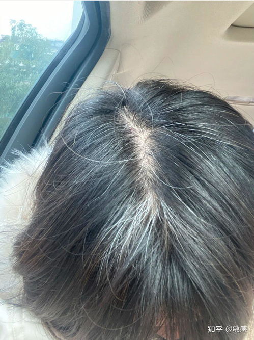 梦见自己头发白了好多是什么征兆:梦见自己头发白了好多是什么征兆?梦境启示与心理解读 梦见自己头发白了好多是什么征兆:梦见自己头发白了好多是什么征兆?梦境启示与心理解读