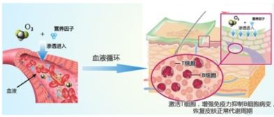 角质层薄怎么修复：角质层薄怎么修复？这些方法超有效！