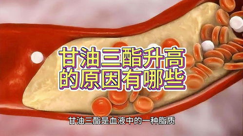 甘油三酯高吃什么食物：甘油三酯高吃什么食物？这5类食物帮你降低血脂！