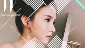 隆鼻手术后多久可以完全恢复正常:隆鼻手术后多久可以完全恢复正常?全面解析恢复时间线 隆鼻手术后多久可以完全恢复正常:隆鼻手术后多久可以完全恢复正常?全面解析恢复时间线