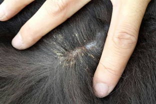 虱子图片:虱子图片,认识与防治 虱子图片:虱子图片,认识与防治