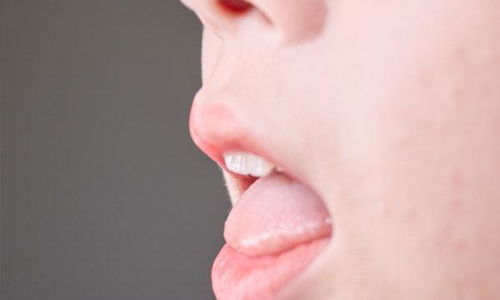 茯苓怎样吃才去除体内湿气:茯苓食养祛湿,传统智慧助你轻松摆脱体内湿气困扰