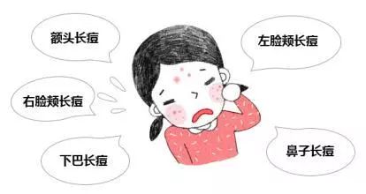 痤疮好了还会复发吗:痤疮真的会复发吗?看完这篇你就明白了