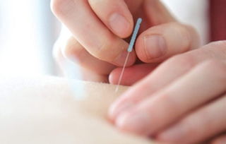 针灸减肥20斤需要多久:针灸减肥20斤需要多久?探索中医针灸的瘦身效果与时间