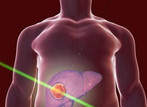 肝脏开始变硬有6种迹象：肝脏开始变硬有6种迹象，你中招了吗？