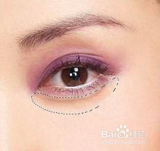 永久去除眼袋的最快方法:告别眼袋烦恼,探寻永久去除眼袋的最快有效方法 永久去除眼袋的最快方法:告别眼袋烦恼,探寻永久去除眼袋的最快有效方法