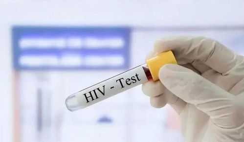 三个症状提醒你感染了艾滋病：这3个症状出现，可能是艾滋病在敲门！专家提醒，别忽视，尽快检测！