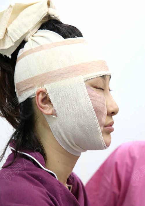 除皱手术是怎么做的:揭秘除皱手术,从术前准备到术后恢复的全过程 除皱手术是怎么做的:揭秘除皱手术,从术前准备到术后恢复的全过程