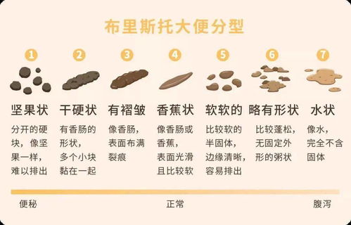 梦到拉屎的解梦:梦到拉屎的解梦,潜意识中的释放与警示 梦到拉屎的解梦:梦到拉屎的解梦,潜意识中的释放与警示