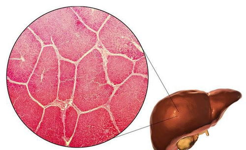 总胆红素高是怎么回事:总胆红素高是怎么回事?这些原因你一定要知道!