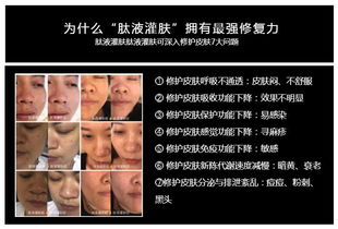 美白手术大概多少钱：美白手术价格参考，了解费用构成与注意事项