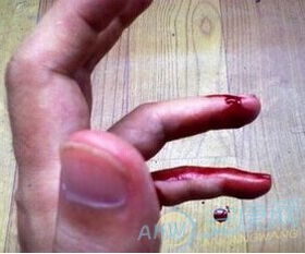 梦见狗咬手没有出血是怎么回事：解密梦境，为何梦见被狗咬手却不流血？