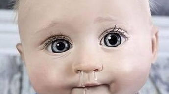 鼻子塌怎么办：鼻子塌了怎么办？重塑挺拔鼻梁的多种方法与注意事项