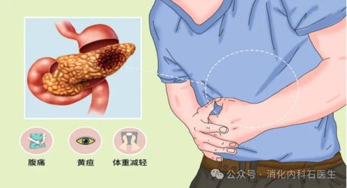 男性左下腹部隐痛的原因：警惕！男性左下腹部隐痛的七大可能原因