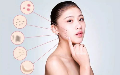 激素脸去医院好还是美容院好：激素脸去医院好还是美容院好？专业解析与选择指南