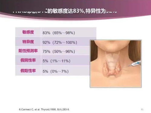 甲状腺结节3类吃小金丸：甲状腺结节3类，吃小金丸有用吗？权威医生解答来了！