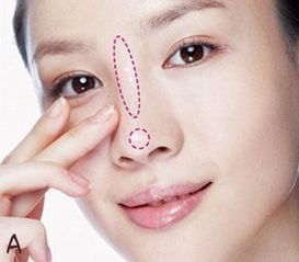 弄鼻子需要多少钱：弄鼻子需要多少钱？单鼻翼缩小与隆鼻手术费用全解析