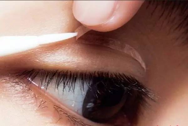 眼睑外翻自己恢复好了：神奇！我的眼睑外翻竟然自己恢复好了，分享几个关键自救方法