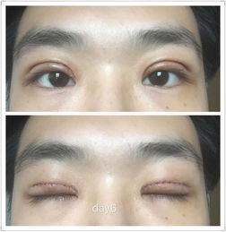 男人右眼皮跳太准了：男人右眼皮跳太准了？科学揭秘与民间智慧的双重解读