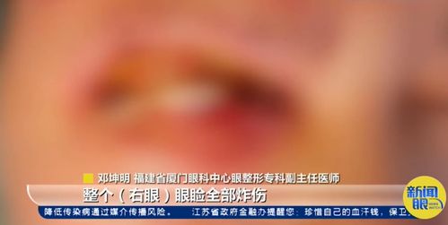 男人右眼皮跳太准了：男人右眼皮跳太准了？科学揭秘与民间智慧的双重解读
