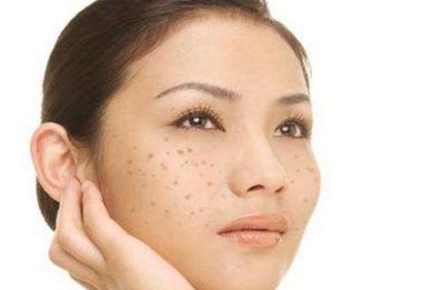 过敏一般几天能恢复：过敏恢复期，了解症状与恢复时间