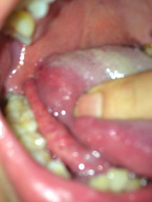 喉咙咽口水刺痛小妙招：喉咙咽口水刺痛怎么办？这些小妙招帮你快速缓解不适！