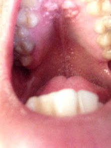 喉咙咽口水刺痛小妙招:喉咙咽口水刺痛怎么办?这些小妙招帮你快速缓解不适! 喉咙咽口水刺痛小妙招:喉咙咽口水刺痛怎么办?这些小妙招帮你快速缓解不适!