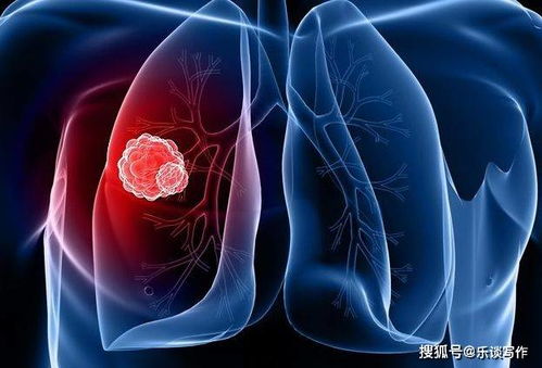 肺部有肿瘤一般会哪里痛：肺癌疼痛，这些部位最常被忽略的警示信号
