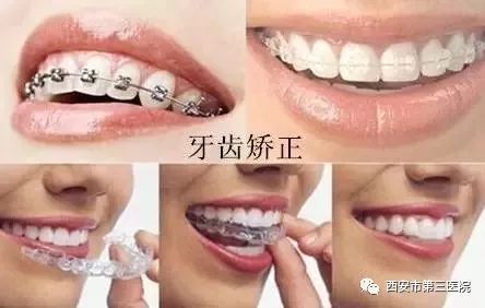 成年以后千万别整牙：成年后千万别整牙，你真的需要矫正牙齿吗？