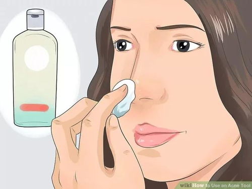 去除鸡眼的小妙招：手到擒来！这些简单又有效的去除鸡眼小妙招，你值得拥有！