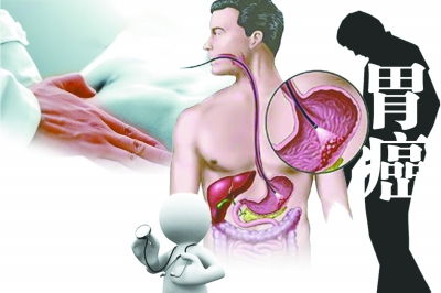 偏瘦的人怎么调理才能吃胖:偏瘦人士增重指南,科学调理,健康吃胖有方法 偏瘦的人怎么调理才能吃胖:偏瘦人士增重指南,科学调理,健康吃胖有方法