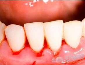 梦到牙掉了三个好兆头：梦到牙掉了三个吉兆，事业突破、人缘上升与好运降临