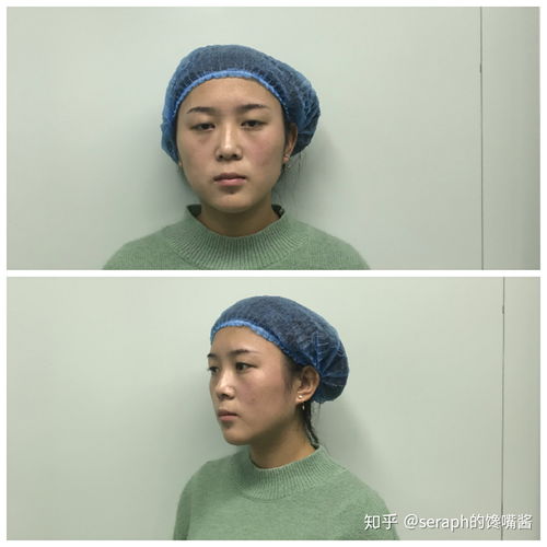 郑州割双眼皮最好的正规医院:郑州割双眼皮哪家正规医院好?2023年权威推荐TOP榜单 郑州割双眼皮最好的正规医院:郑州割双眼皮哪家正规医院好?2023年权威推荐TOP榜单