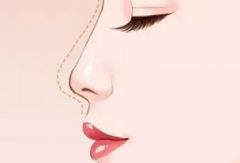 隆鼻手术整形美容医院:选择隆鼻手术整形美容医院的五大关键点