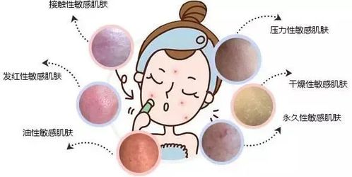 皮肤过敏图片真实:真实皮肤过敏图片大公开,这些症状你中招了吗? 皮肤过敏图片真实:真实皮肤过敏图片大公开,这些症状你中招了吗?
