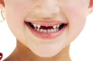 梦见掉牙为什么要说破:梦里掉牙为何要说破,民间智慧与科学解析