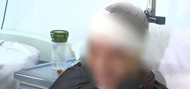 梦见蛆虫爬到身上清除:梦中蛆虫爬身,一场潜意识的吞噬与净化