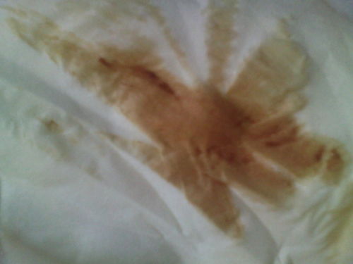 月经十天了擦拭老有褐色分泌物怎么回事：月经十天了，擦拭仍有褐色分泌物？这些原因你一定要知道！