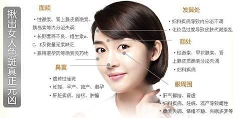 脸上长斑去除小偏方：脸上长斑困扰？试试这些简单又有效的去除小偏方！