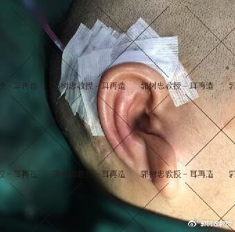 梦见耳朵流血代表什么:梦见耳朵流血,探索潜意识中的神秘信号