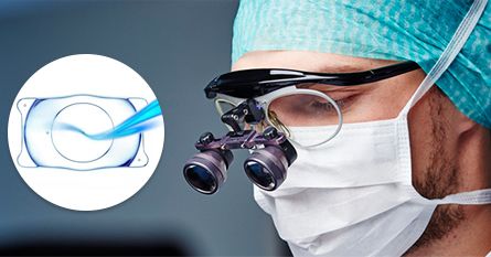 icl晶体植入多少钱:ICL晶体植入到底要花多少钱?看完这篇你就懂了! icl晶体植入多少钱:ICL晶体植入到底要花多少钱?看完这篇你就懂了!